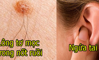 Những điểm lạ xuất hiện trên cơ thể chứng tỏ bạn sắp gặp vận may, phát tài phát lộc - Blog Marry